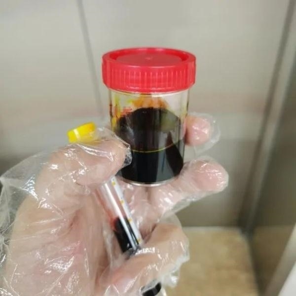 急性肝衰竭！兩兄弟誤吃這種菌 專家提醒