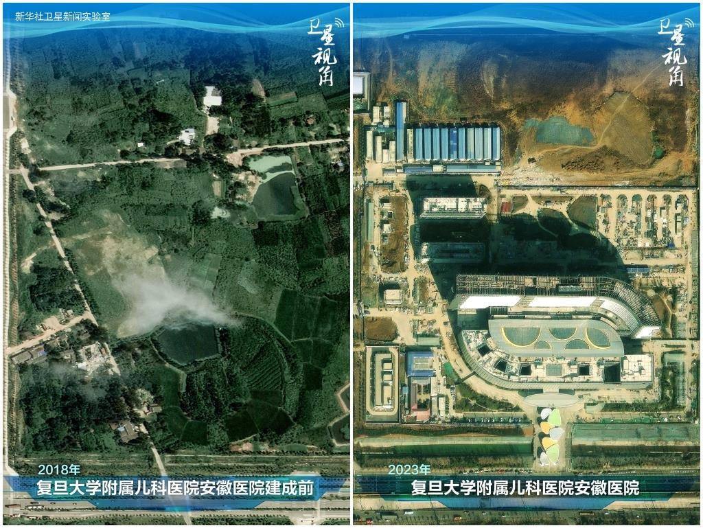 2023年與2018年相比，復(fù)旦大學(xué)附屬兒科醫(yī)院安徽醫(yī)院從一片荒地到建成投用。該項(xiàng)目是安徽省在長三角一體化高質(zhì)量發(fā)展衛(wèi)生健康領(lǐng)域的重大項(xiàng)目，也是安徽首批落地的國家區(qū)域醫(yī)療中心。